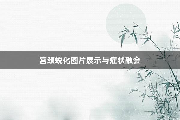 宫颈蜕化图片展示与症状融会